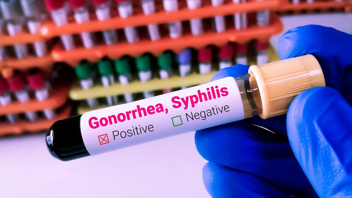 Europe Records Highest Ever Cases of Gonorrhoea and Syphilis