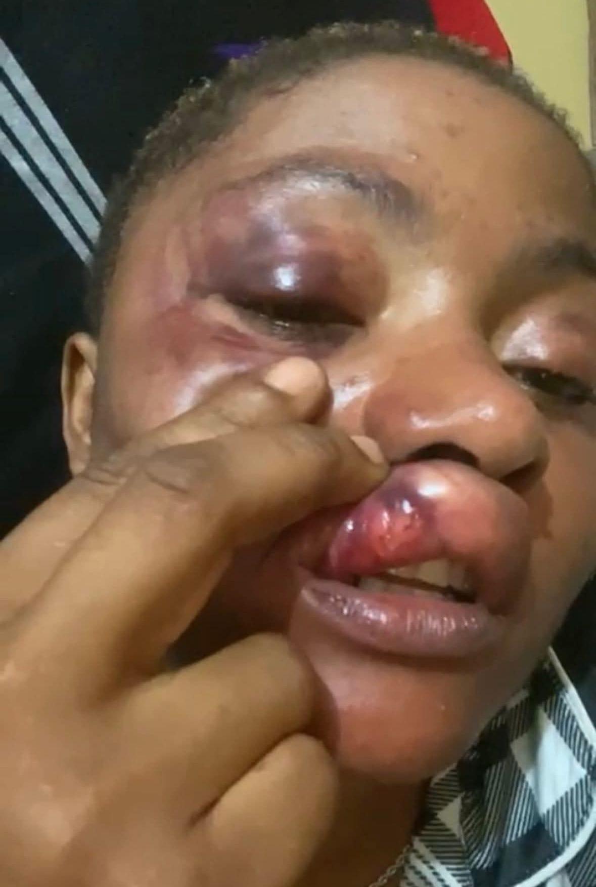 Nikki Reveals Painful Scars From 'Devil in Human Clothes' Marriage