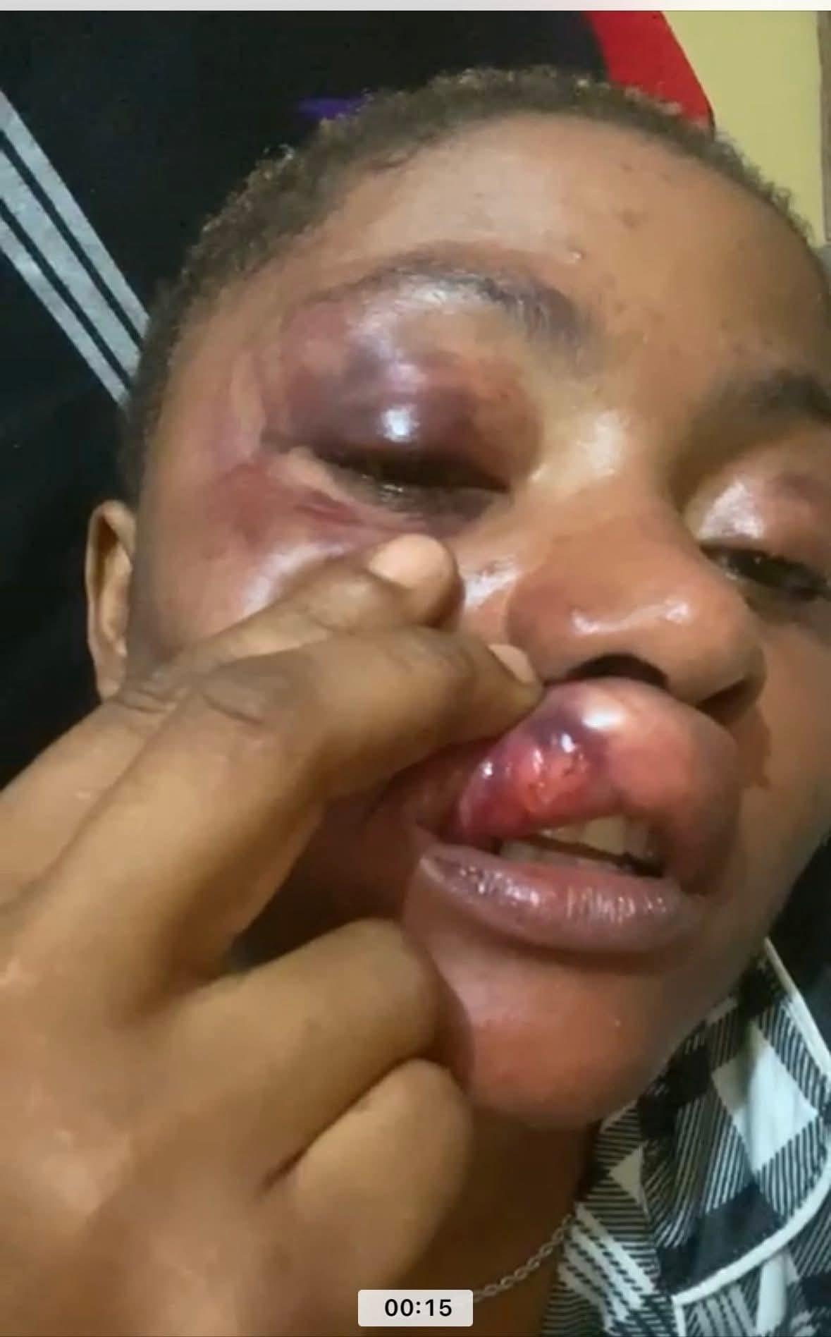 Nigerian woman Nikki shares a photo online, recounting her traumatic past marriage experience.
