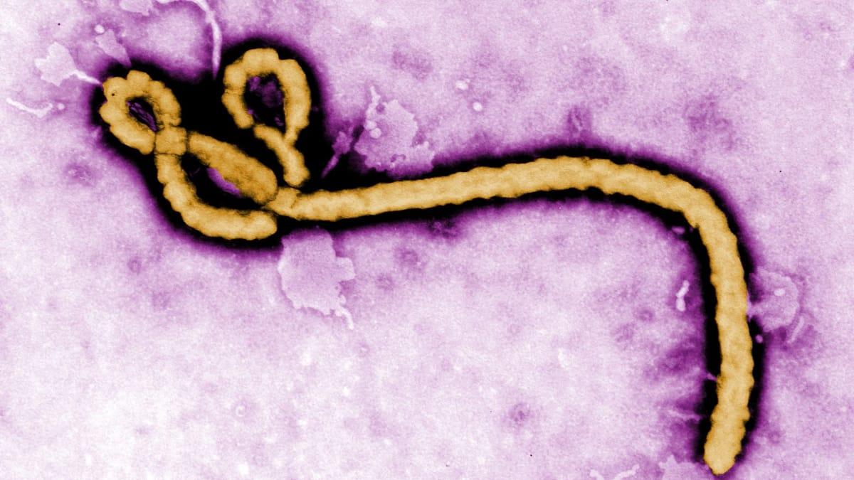 An illustration depicting the Ebola virus, responsible for the ongoing health crisis in the Democratic Republic of Congo.