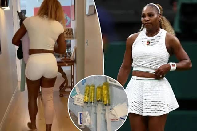 Knee Injury Forces Serena Williams Out of Wimbledon Doubles with Sister Venus