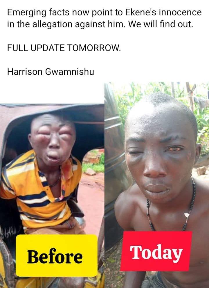 Ekene Agala's appearance, as shared by activist Harrison Gwamnishu, highlighting the impact of the alleged N2 million theft accusation and subsequent mob attack.
