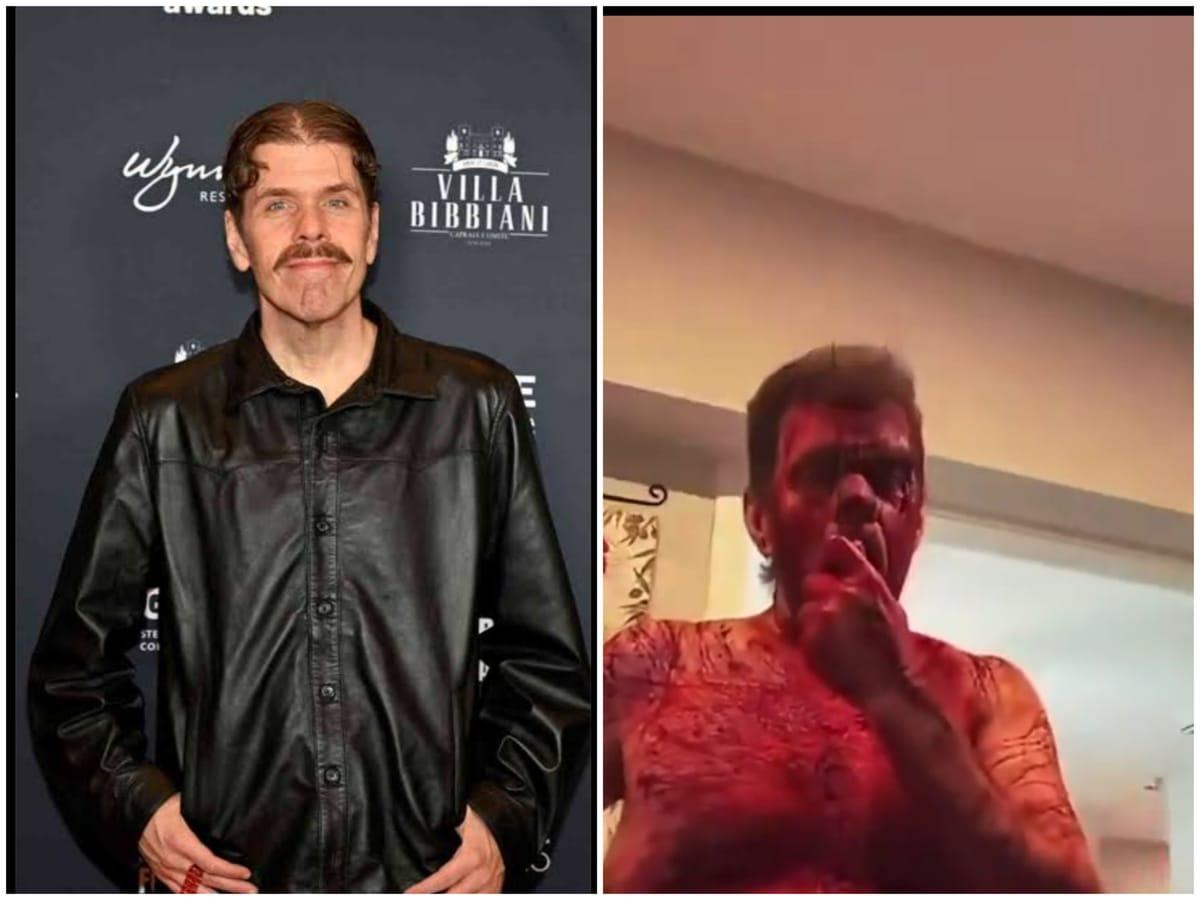 Perez Hilton Rushed to Hospital After Disturbing TikTok Video