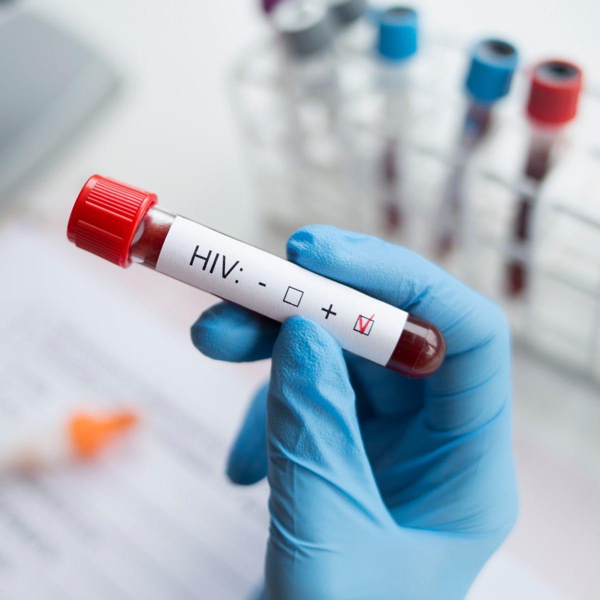 Harare Clinic Grapples with Daily STI Surge, 40% HIV Positive
