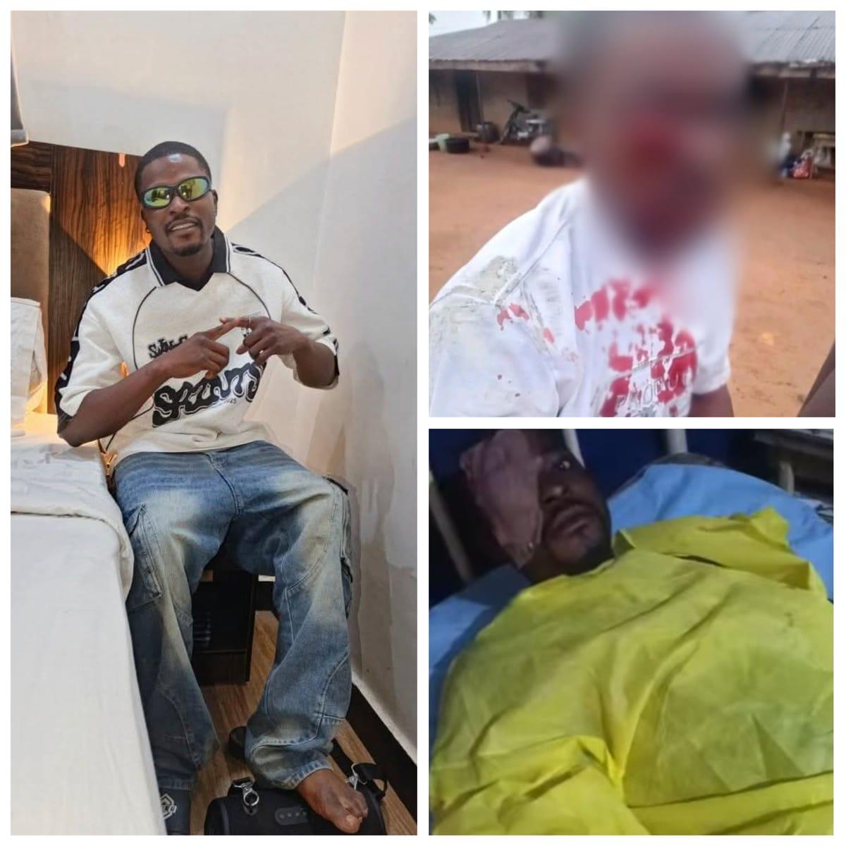 Ebonyi Police Detain Officers Over Civilian's Alleged Eye Injury