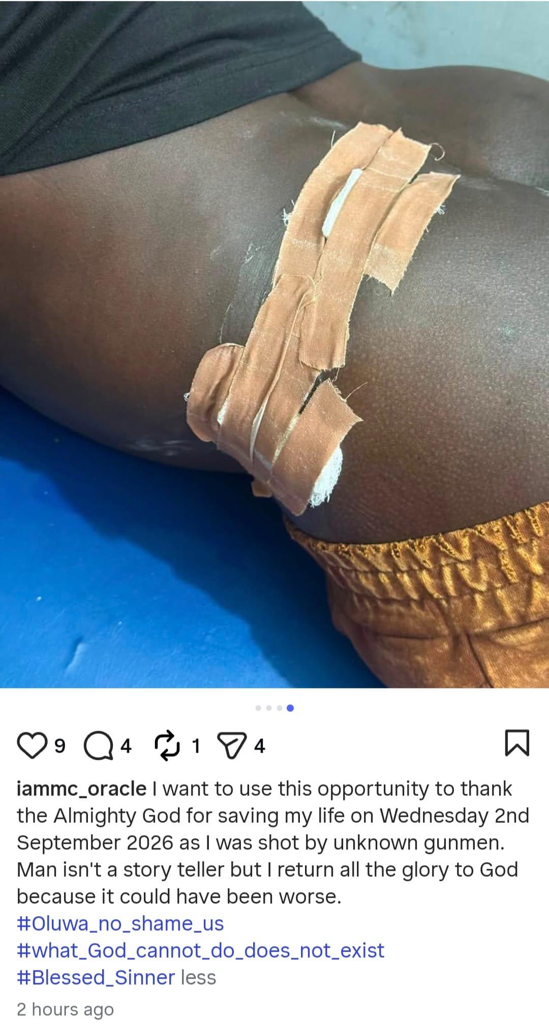 Comedian MC Oracle showing his bandaged injury while recovering in hospital.