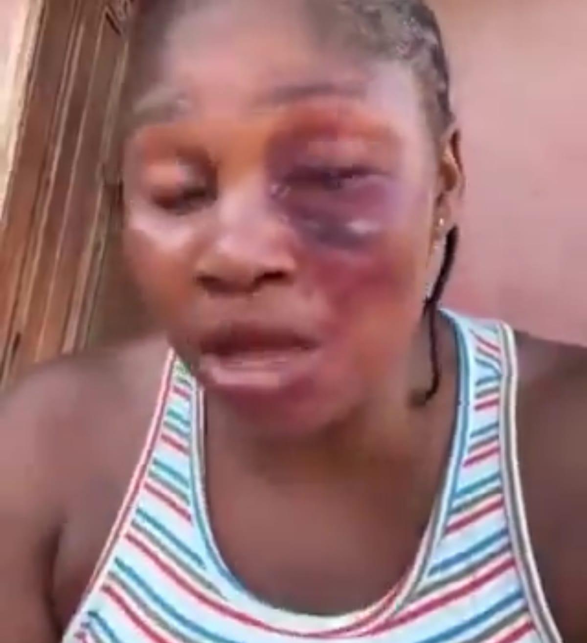 Lagos Woman Suffers Eye Injury After Rejecting Benue Man's Advances