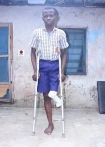 N2m appeal to restore teen's mobility after lifelong leg deformity struggle