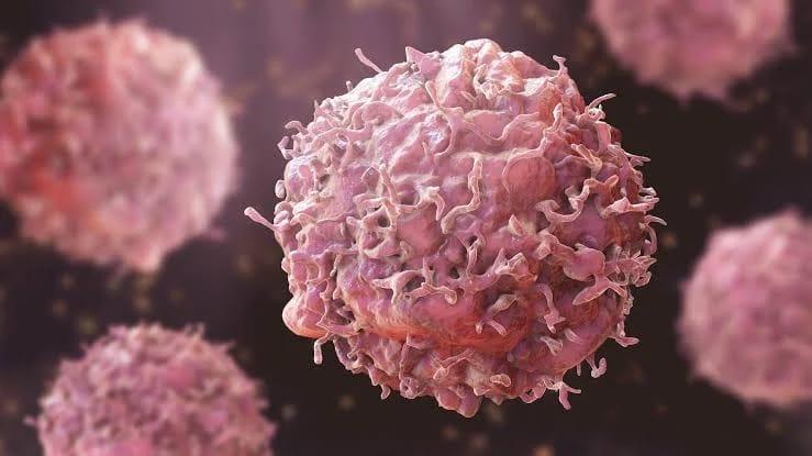 Early Alarm Critical for Cancer Survival, Oncologist Advises Nigerians